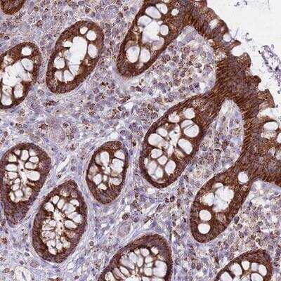 Immunohistochemistry-Paraffin ALKBH4 Antibody