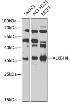 Western Blot: ALKBH4 Antibody [NBP2-92817] - Analysis of extracts of various cell lines, using ALKBH4 at 1:1000 dilution.Secondary antibody: HRP Goat Anti-Rabbit IgG (H+L) at 1:10000 dilution.Lysates/proteins: 25ug per lane.Blocking buffer: 3% nonfat dry milk in TBST.Detection: ECL Basic Kit .Exposure time: 10s.