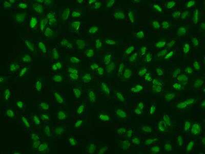 Immunocytochemistry/Immunofluorescence: ALKBH5 Antibody [NBP3-06321] -  Staining of ALKBH5 in U2OS cells. Cells were fixed with 4% PFA, permeabilzed with 0.1% Triton X-100 in PBS,blocked with 10% serum, and incubated with rabbit anti-Human ALKBH5 polyclonal antibody (dilution ratio 1:200) at 4? overnight. Then cells were stained with the Alexa Fluor®488-conjugated Goat Anti-rabbit IgG secondary antibody (green). Positive staining was localized to Nucleus.