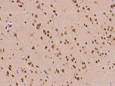 Immunohistochemistry-Paraffin: ALKBH5 Antibody [NBP3-06321] - Staining of human ALKBH5 in human brain with rabbit polyclonal antibody at 1:100 dilution.