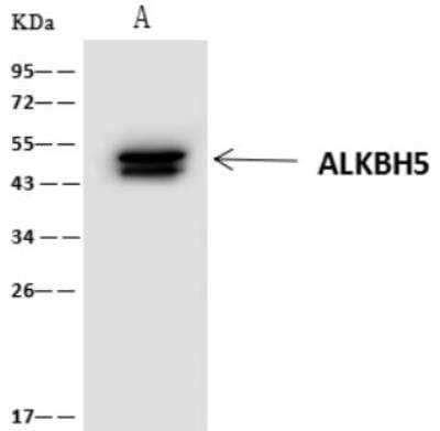 Immunoprecipitation: ALKBH5 Antibody [NBP3-06321] - Lane A:0.5 mg 293 Whole Cell Lysate 4 uL anti-ALKBH5 rabbit polyclonal antibody and 60 ug of Immunomagnetic beads Protein A/G. Primary antibody:Anti-ALKBH5 rabbit polyclonal antibody,at 1:100 dilution Secondary antibody:Clean-Blot IP Detection Reagent (HRP) at 1:1000 dilution. Developed using the ECL technique. Performed under reducing conditions. Predicted band size: 44 kDaObserved band size :50 kDa