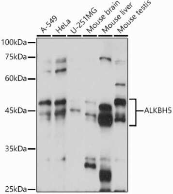 Western Blot: ALKBH5 Antibody [NBP2-92048] - Western blot analysis of extracts of various cell lines, using ALKBH5 antibody (NBP2-92048) at 1:1000 dilution. Secondary antibody: HRP Goat Anti-Rabbit IgG (H+L) at 1:10000 dilution. Lysates/proteins: 25ug per lane. Blocking buffer: 3% nonfat dry milk in TBST. Detection: ECL Basic Kit. Exposure time: 30s.