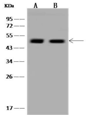Western Blot: ALKBH5 Antibody [NBP3-06321] - Lane A: 293 Whole Cell Lysate Lane B: U-251 MG Whole Cell Lysate Lysates/proteins at 30 ug per lane. Secondary Goat Anti-Rabbit IgG (H+L)/HRP at 1/10000 dilution. Developed using the ECL technique. Performed under reducing conditions. Predicted band size:44 kDa Observed band size:48 kDa