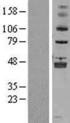 Western Blot: ALKBH5 Overexpression Lysate (Adult Normal) [NBL1-07476] Left-Empty vector transfected control cell lysate (HEK293 cell lysate); Right -Over-expression Lysate for ALKBH5.