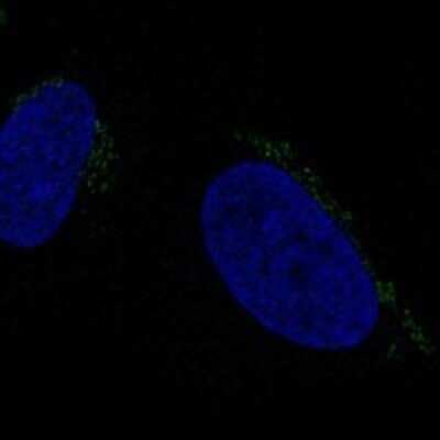 Immunocytochemistry/Immunofluorescence: ALKBH7 Antibody [NBP3-17280] - Staining of human cell line U-2 OS shows localization to mitochondria.