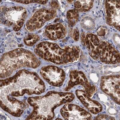 Immunohistochemistry ALKBH7 Antibody