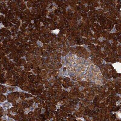 Immunohistochemistry-Paraffin: ALKBH7 Antibody [NBP1-81231] - Staining of human pancreas shows strong cytoplasmic positivity in exocrine glandular cells.