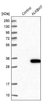 Western Blot ALKBH7 Antibody