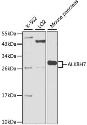 Western Blot: ALKBH7 Antibody [NBP2-92409] - Analysis of extracts of various cell lines, using ALKBH7 at 1:1000 dilution.Secondary antibody: HRP Goat Anti-Rabbit IgG (H+L) at 1:10000 dilution.Lysates/proteins: 25ug per lane.Blocking buffer: 3% nonfat dry milk in TBST.Detection: ECL Basic Kit .Exposure time: 90s.