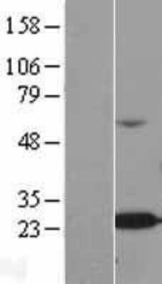 Western Blot: ALKBH7 Overexpression Lysate (Adult Normal) [NBL1-07477] Left-Empty vector transfected control cell lysate (HEK293 cell lysate); Right -Over-expression Lysate for ALKBH7.