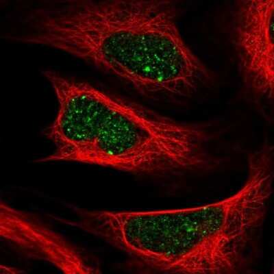 Immunocytochemistry/ Immunofluorescence ALKBH8 Antibody