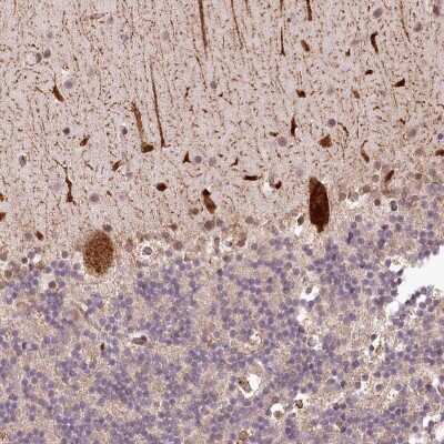 Immunohistochemistry: ALKBH8 Antibody [NBP2-38428] - Staining of human cerebellum shows strong cytoplasmic positivity in Purkinje cells.