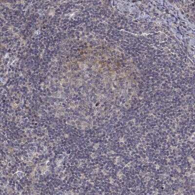 Immunohistochemistry-Paraffin ALKBH8 Antibody