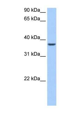 Western Blot: ALKBH8 Antibody [NBP1-80473] - Human Liver cell lysate, concentration 0.2-1 ug/ml.
