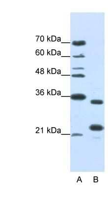 Western Blot: ALKBH8 Antibody [NBP1-80474] - Jurkat cell lysate, concentration 1.0ug/ml.