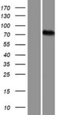 Western Blot: ALKBH8 Overexpression Lysate (Adult Normal) [NBP2-10239] Left-Empty vector transfected control cell lysate (HEK293 cell lysate); Right -Over-expression Lysate for ALKBH8.