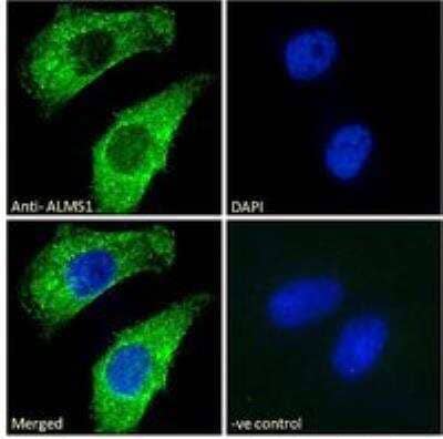 Immunocytochemistry/Immunofluorescence: ALMS1 Antibody [NB100-1195] - Immunofluorescence analysis of paraformaldehyde fixed HeLa cells, permeabilized with 0.15% Triton. Primary incubation 1hr (10 ug/mL) followed by Alexa Fluor 488 secondary antibody (2 ug/mL), showing cytoplasmic staining. The nuclear stain is DAPI (blue). Negative control: Unimmunized goat IgG (10 ug/mL) followed by Alexa Fluor 488 secondary antibody (2 ug/mL).