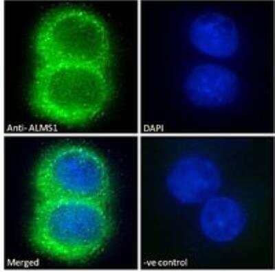 Immunocytochemistry/Immunofluorescence: ALMS1 Antibody [NB100-1195] - Immunofluorescence analysis of paraformaldehyde fixed HepG2 cells, permeabilized with 0.15% Triton. Primary incubation 1hr (10 ug/mL) followed by Alexa Fluor 488 secondary antibody (2 ug/mL), showing cytoplasmic staining. The nuclear stain is DAPI (blue). Negative control: Unimmunized goat IgG (10ug/ml) followed by Alexa Fluor 488 secondary antibody (2 ug/mL).