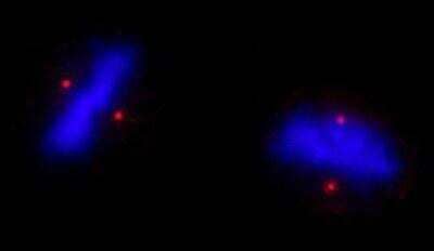 Immunocytochemistry/Immunofluorescence: ALMS1 Antibody [NB100-97823] - NBF-fixed asynchronous HeLa cells. At a dilution of 1:250.