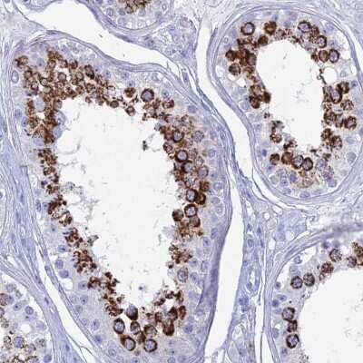 Immunohistochemistry-Paraffin ALMS1 Antibody