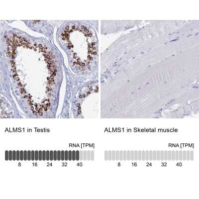 <b>Orthogonal Strategies Validation. </b>Immunohistochemistry-Paraffin: ALMS1 Antibody [NBP1-83015] - Staining in human testis and skeletal muscle tissues using anti-ALMS1 antibody. Corresponding ALMS1 RNA-seq data are presented for the same tissues.