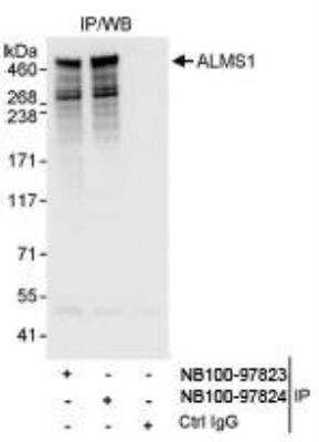 Immunoprecipitation ALMS1 Antibody - BSA Free