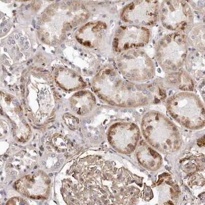 Immunohistochemistry-Paraffin: ALPK1 Antibody [NBP1-83594] - Staining of human kidney shows moderate positivity in cells in tubules and glomeruli.