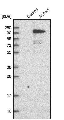 Western Blot: ALPK1 Antibody [NBP1-83594] - Analysis in control (vector only transfected HEK293T lysate) and ALPK1 over-expression lysate (Co-expressed with a C-terminal myc-DDK tag (3.1 kDa) in mammalian HEK293T cells).