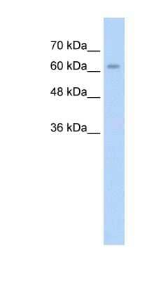 Western Blot: ALPPL2 Antibody [NBP1-57946] - HepG2 cell lysate, concentration 2.5 ug/ml.