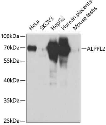 Western Blot: ALPPL2 Antibody [NBP2-92478] - Analysis of extracts of various cell lines, using ALPPL2 at 1:1000 dilution.Secondary antibody: HRP Goat Anti-Rabbit IgG (H+L) at 1:10000 dilution.Lysates/proteins: 25ug per lane.Blocking buffer: 3% nonfat dry milk in TBST.Detection: ECL Basic Kit .Exposure time: 3s.