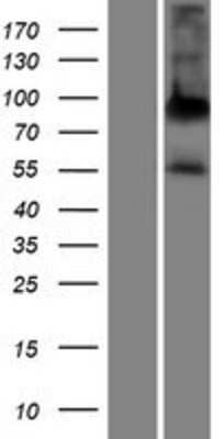 Western Blot: ALPPL2 Overexpression Lysate (Adult Normal) [NBP2-06138] Left-Empty vector transfected control cell lysate (HEK293 cell lysate); Right -Over-expression Lysate for ALPPL2.