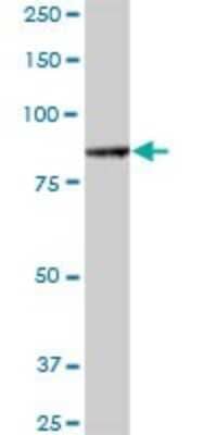 Western Blot ALS2CL Antibody