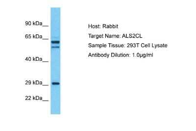 Western Blot ALS2CL Antibody