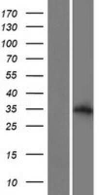 Western Blot: ALS2CL Overexpression Lysate (Adult Normal) [NBP2-04811] Left-Empty vector transfected control cell lysate (HEK293 cell lysate); Right -Over-expression Lysate for ALS2CL.