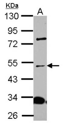 Western Blot: ALS2CR15 Antibody [NBP2-15367] - Sample (30 ug of whole cell lysate) A: A431 10% SDS PAGE; antibody diluted at 1:1000.