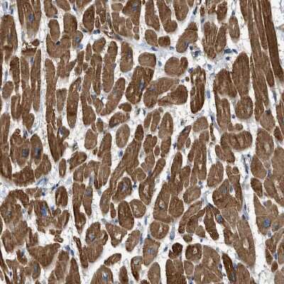 Immunohistochemistry-Paraffin: ALS2CR3 Antibody [NBP1-90182] - Staining of human Heart shows strong cytoplasmic positivity in cardiomyocytes.