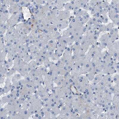 Immunohistochemistry-Paraffin: ALS2CR3 Antibody [NBP1-90182] - Staining of human Liver shows very weak cytoplasmic positivity in hepatocytes.