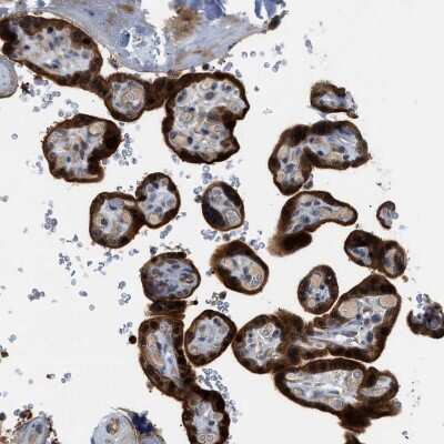 Immunohistochemistry-Paraffin: ALS2CR3 Antibody [NBP1-90182] - Staining of human Placenta shows strong cytoplasmic positivity in trophoblastic cells.