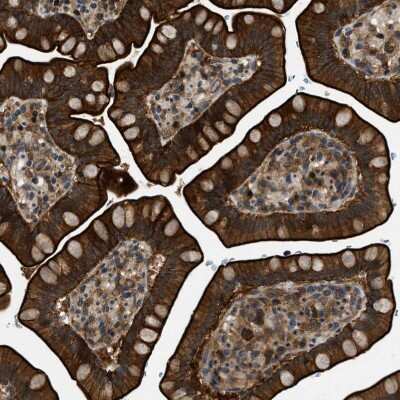 Immunohistochemistry-Paraffin: ALS2CR3 Antibody [NBP1-90182] - Staining of human Small intestine shows strong membranous and cytoplasmic positivity in glandular cells.