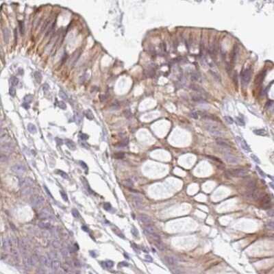 Immunohistochemistry-Paraffin: ALS2CR4 Antibody [NBP2-33731] - Staining of human colon.