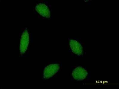 Immunocytochemistry/Immunofluorescence: ALS2CR8 Antibody [H00079800-B01P] - Analysis of purified antibody to ALS2CR8 on HeLa cell. (antibody concentration 10 ug/ml)
