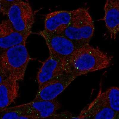 Immunocytochemistry/Immunofluorescence: ALS2CR8 Antibody [NBP2-68649] - Staining of human cell line SH-SY5Y shows localization to vesicles.