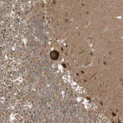 Immunohistochemistry-Paraffin: ALS2CR8 Antibody [NBP1-86627] - Staining of human cerebellum shows strong cytoplasmic and nucleolar positivity in purkinje cells.