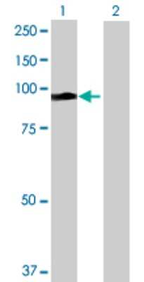 Western Blot: ALS2CR8 Overexpression Lysate [H00079800-T01] - Lane 1: ALS2CR8 transfected lysate (79.09 KDa) Lane 2: Non-transfected lysate.