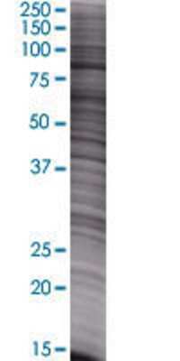 Western Blot: ALS2CR8 Overexpression Lysate [H00079800-T01] - ALS2CR8 transfected lysate.