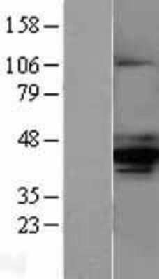 Western Blot: alpha-Methylacyl-CoA Racemase/AMACR Overexpression Lysate [NBL1-07494] -  Left-Empty vector transfected control cell lysate (HEK293 cell lysate); Right -Over-expression Lysate for AMACR.