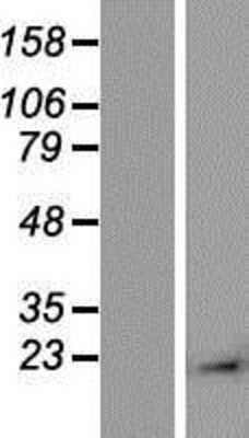 Western Blot: alpha-Methylacyl-CoA Racemase/AMACR Overexpression Lysate [NBP2-10123] - Left-Empty vector transfected control cell lysate (HEK293 cell lysate); Right -Over-expression Lysate for AMACR.