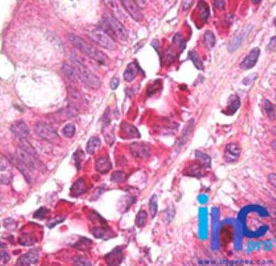 Immunohistochemistry-Paraffin: AMBRA1 Antibody [NBP2-24723] - Formalin-fixed, paraffin-embedded human small intestine stained with Ambra1 antibody at 10 ug/ml. Staining of formalin-fixed tissues is enhanced by boiling tissue sections in 10 mM sodium citrate buffer, pH 6.0 for 10-20 min followed by cooling at RT for 20 min.