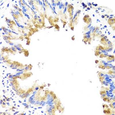 Immunohistochemistry-Paraffin: AMBRA1 Antibody [NBP2-92849] - Paraffin-embedded mouse lung using AMBRA1 .
