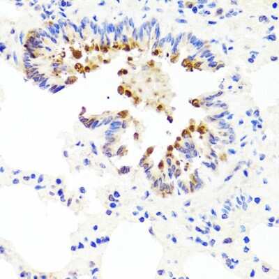 Immunohistochemistry-Paraffin: AMBRA1 Antibody [NBP2-92849] - Paraffin-embedded rat lung using AMBRA1 .